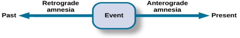 A single-line flow diagram compares two types of amnesia. In the center is a box labeled “event” with arrows extending from both sides. Extending to the left is an arrow pointing left to the word “past”; the arrow is labeled “retrograde amnesia.” Extending to the right is an arrow pointing right to the word “present”; the arrow is labeled “anterograde amnesia.”